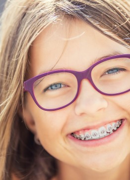 Брекеты Damon Q