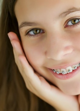 Брекеты для взрослых