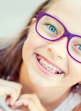 Брекеты для-детей