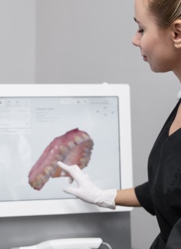 Цифровое 3D сканирование челюсти