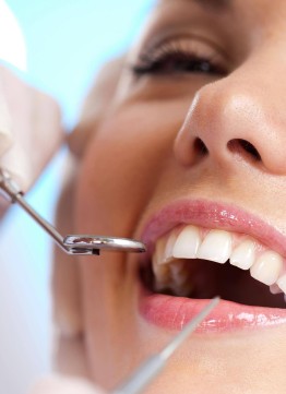 Наращивание зубов