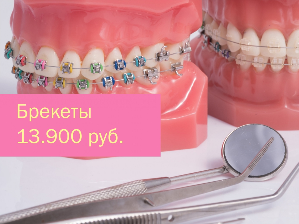 Скидка на брекеты 5000р.