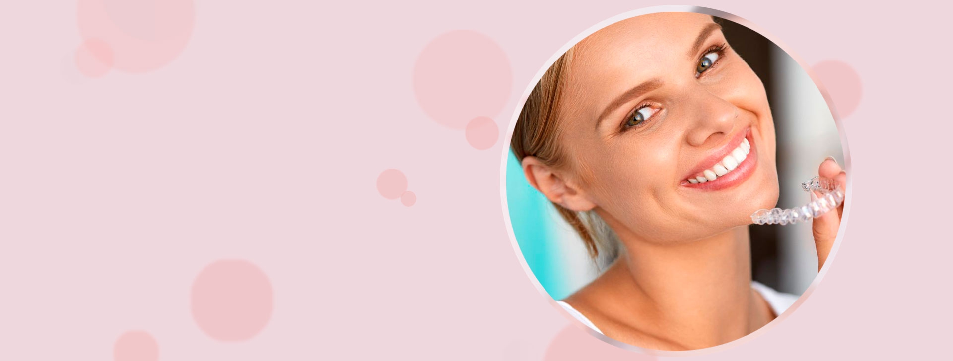 Элайнеры. Каппы