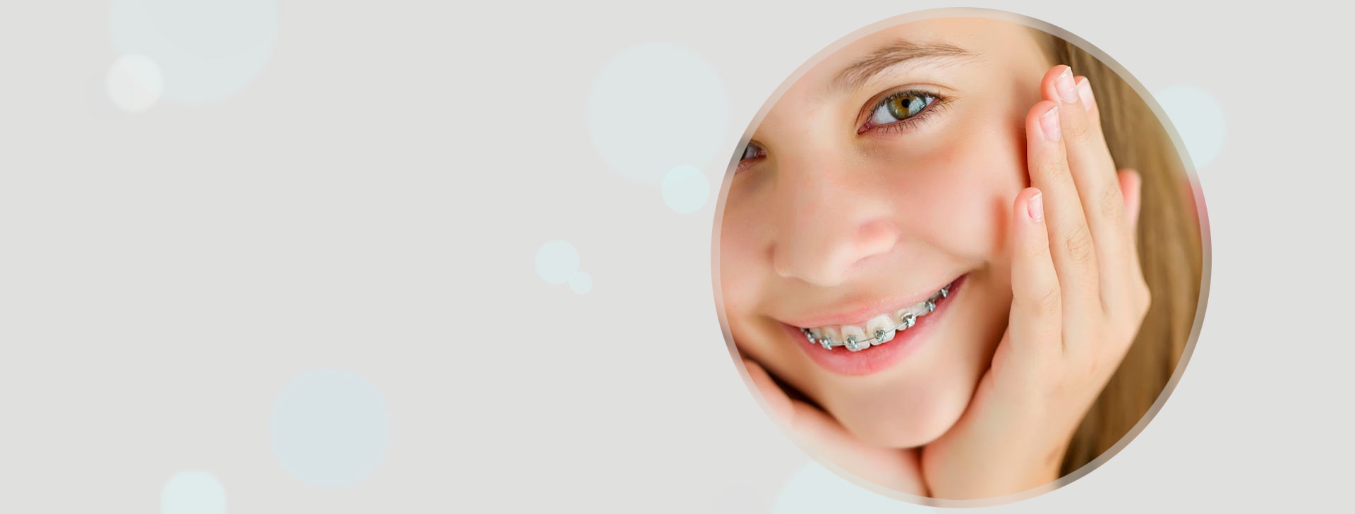 Металлические брекеты